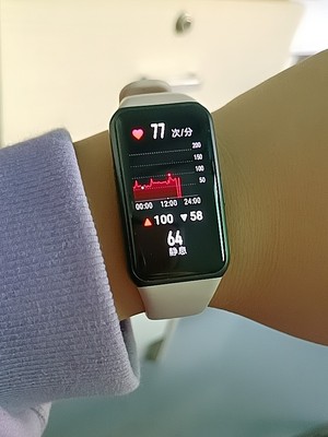 荣耀运动手环6，NFC血氧心率监测5代升级智能手表插图6