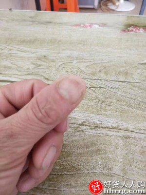托嗳灰指甲专用液脱甲膏，灰指甲怎么根治简单有效的方法插图5