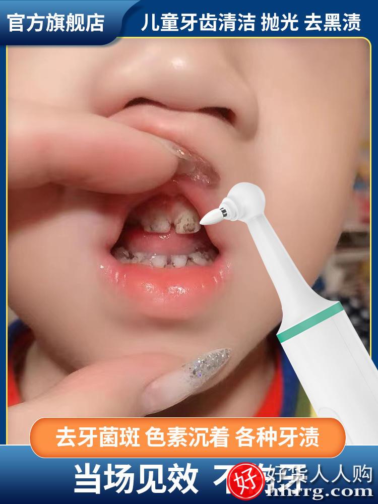 莫兹利儿童牙齿清洁抛光器，洗小黑牙除牙渍牙垢器洗牙器